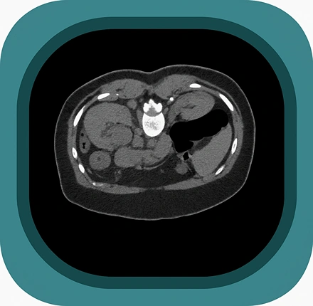 CT kidney ureters bladder (KUB) anatomy icon